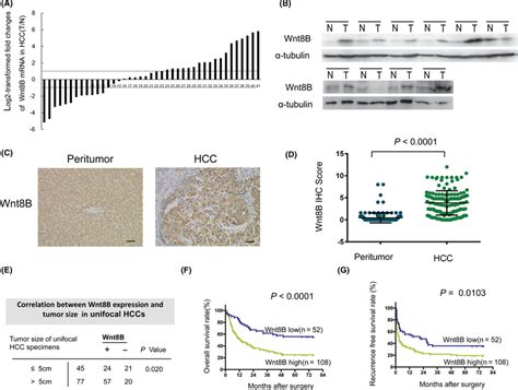 Upregulation Of Wnt8b In Hepatocellular Carcinoma Hcc Is Correlated