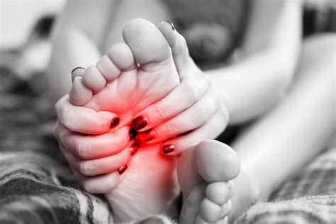 Por qué duele la planta del pie reciprocidad MGC