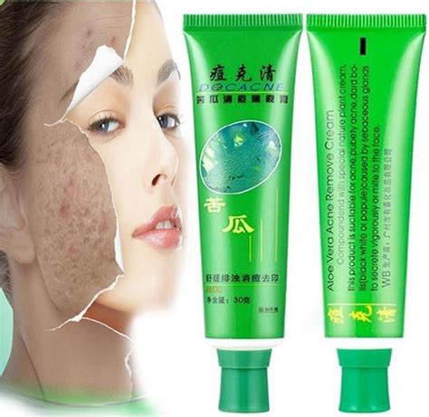 Skin Acne Treatment Cream Fheaven 30g Face Skin Care Acne