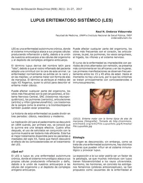Lupus Eritematoso Sistemico Les Medicina 2 Revista De Educación