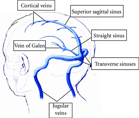 Venous Sinuses Anatomy