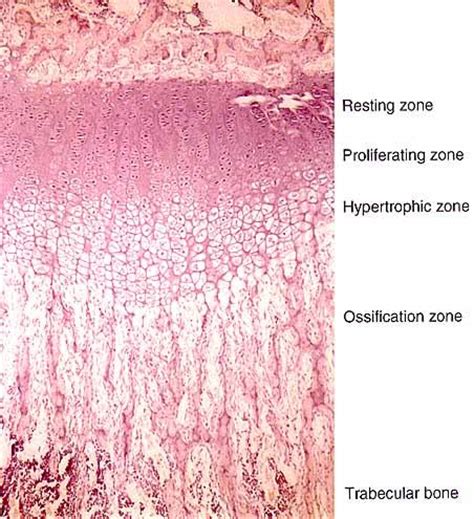 …plate of cartilage, called the epiphyseal plate, persists at the ends of growing bones, finally becoming ossified itself only when the bone behind it has completed its growth. Anatomy & Physiology 220 > Kenyon > Flashcards > Chapter 6 ...