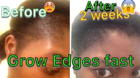 Grow Your Edges Fast In Just 2 Weeks Youtube Edges Hair Grow Edges Instant Hair Growth