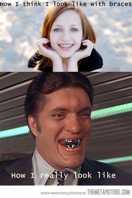 Funny Quotes About Braces On Teeth Shortquotes Cc
