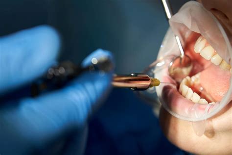 3 Types Of Dental Anesthesia Benefits Side Effects And Risks