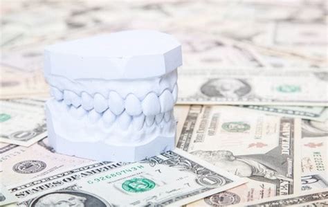 You, your car, and what type of insurance you want to. Dental Crowns Cost | Experienced Dentist in Buffalo