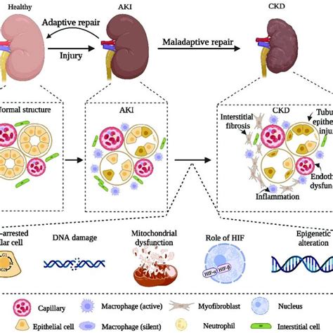 Pdf From Aki To Ckd Maladaptive Repair And The Underlying Mechanisms