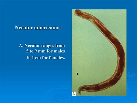 Ancylostomoza Necatoroza Ppt Download