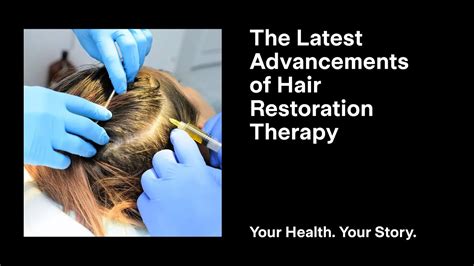 The Latest Advancements Of Hair Restoration Therapy Youtube