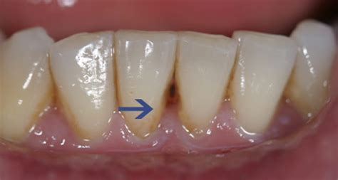 Die kosten für diese pzr und auch für sinnvolle/notwendige. parodontologie - Ihr Zahnarzt in Waiblingen - Dr. Michael ...