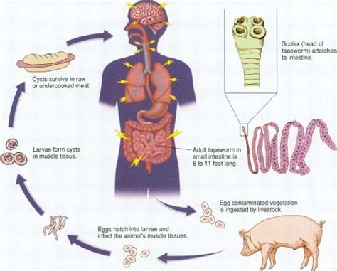 Tape Worm Dietinfection Tapeworm Infectiondisease