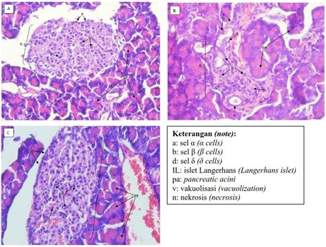 Gambar 1 Gambaran Histopatologi Pankreas Yang Diwarnai Dengan He