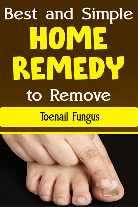 Best And Simple Home Remedy To Remove Toenail Fungus