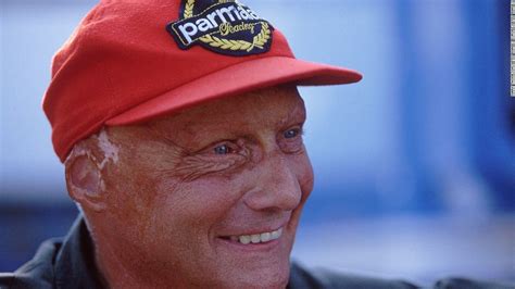 Niki Lauda Burns Burns Face Burns Australian Grand Prix