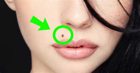 This Is What It Means If You Have A Mole On One Of These 7 Places On