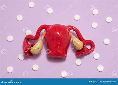 Anatomical Model Of Female Uterus With Ovaries Is On Purple Background