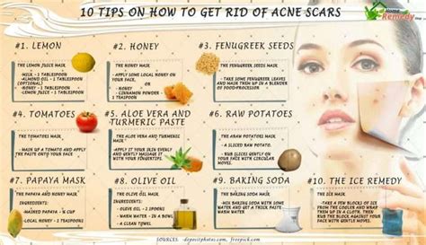 How To Get Rid Of Acne Redness Fast