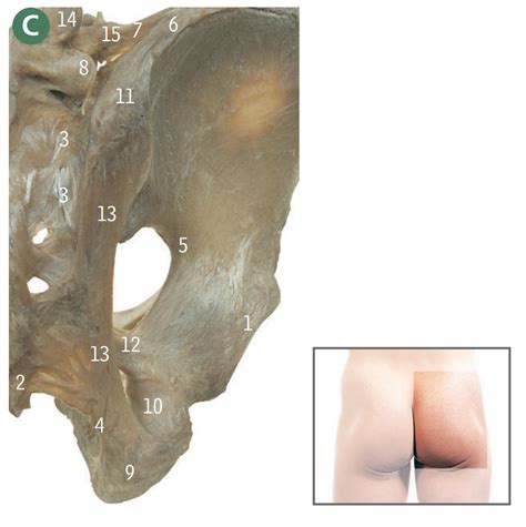 Hip Joint Posterior Pelvis Ligaments Vertebropelvic And Sacroiliac