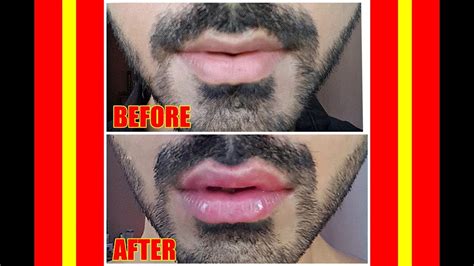 How To Get Bigger Lips In 5 Minutes Diy Natural Lip Plumping For Men