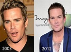Mark McGrath Plastic Surgery Before and After : CELEB-SURGERY.COM
