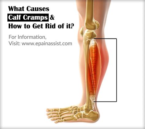 What Causes Calf Cramps And How To Get Rid Of It Calf Cramps Calf