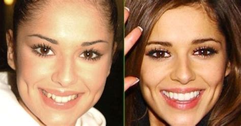 Celebrities That Have Had Cosmetic Dentistry Pictures Before And