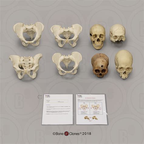Forensic Anthropology K 12 Set Sex Estimation Bone Clones Inc