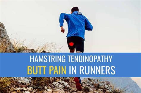 Proximal Hamstring Tendinopathy A Common Cause Of Butt Pain In Runners Sports Injury Physio