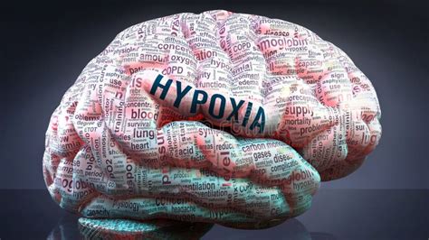 Hypoxia And A Human Brain Stock Illustration Illustration Of Concepts
