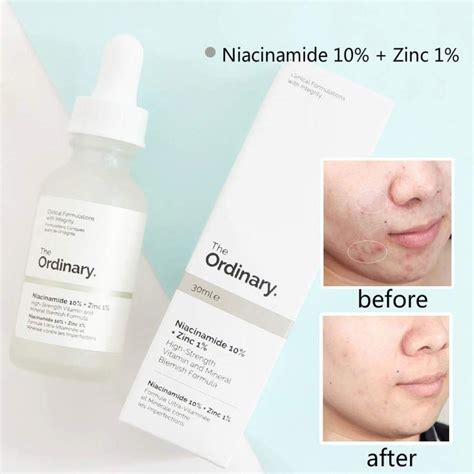 Niacinamide (vitamin b3) is indicated to. READY STOCK The Ordinary Niacinamide 10% + Zinc 1% High ...