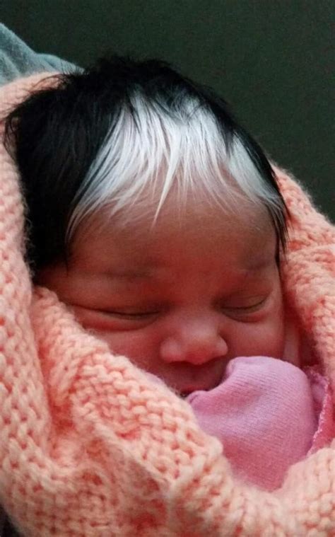 Doctors Finally Realize Why Baby Was Born With Head Full Of Grey Hair Relay Hero