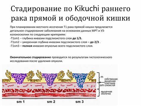 Диета рака ободочной кишки Колоректальный рак - презентация онлайн Колоректальный рак - презентация онлайн Диета рака ободочной кишки