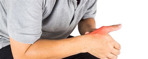 6 Signs Of Gout Or Pseudogout The Hand Society