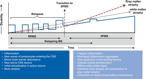 Approaches And Challenges In The Diagnosis And Management Of Secondary Progressive Multiple