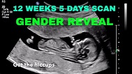 Weeks Days Ultrasound Gender | Hot Sex Picture