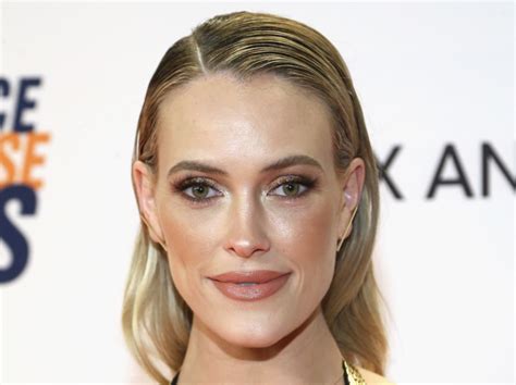 What Happened To Peta Murgatroyd Why Dancing With The Stars Pro