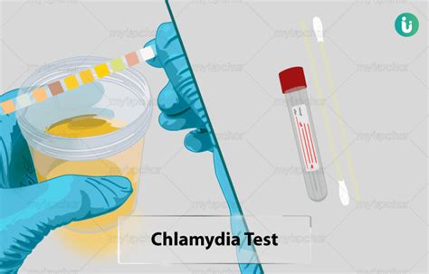 क्लैमिडिया टेस्ट क्या है खर्च कब क्यों कैसे होता है chlamydia test price cost online