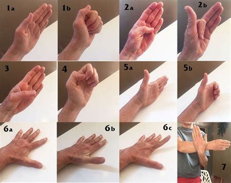 aliviar dolor de artritis en las manos conecta salud