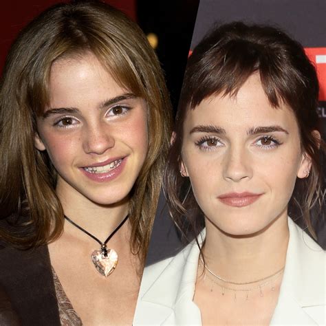 The Evolution Of Emma Watson S Beauty