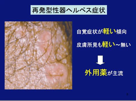 女性 器 かゆい | 女性器をイラストでわかりやすく!女性器の ...