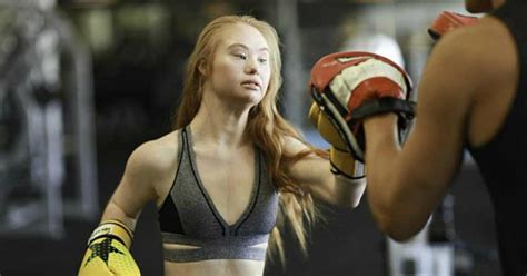 How Down Syndrome Model Madeline Stuart Made It To The Catwalk Celia