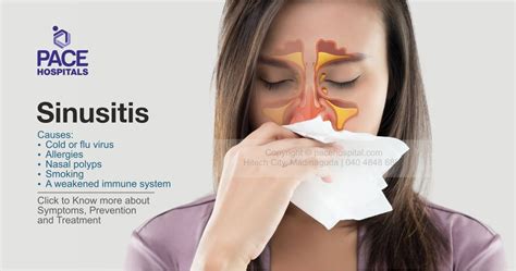 Sinusitis Types Causes Symptoms And Treatment