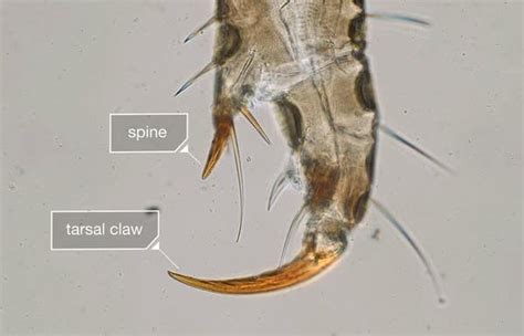 Video Head Lice Up Close And All Too Personal Mpr News