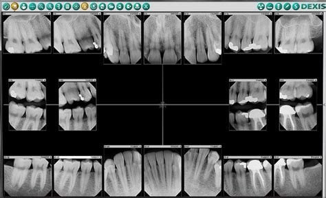 3d Teeth X Ray In Brandon Fl Brandon Cosmetic Dentistry