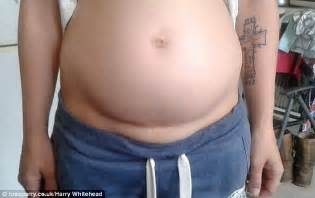 Mystery Of Mother Who Still Looks Pregnant 17 Months After Giving Birth