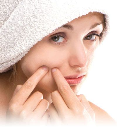 Diy Pimple Treatment Cystic Acne Treatment Homemade Acne Treatment