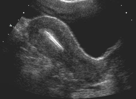 Best Mod Ultrasound Images Ultrasound Sonography Sonography Hot