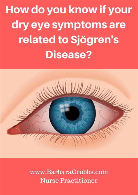 Sjogren S Syndrome Dry Eye Syndrome Primary Vs Second