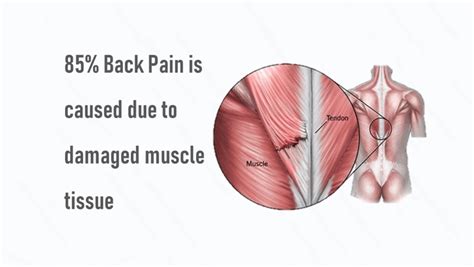 How To Unlock Hip Flexor Causes Of Upper Back Pain And Numbness