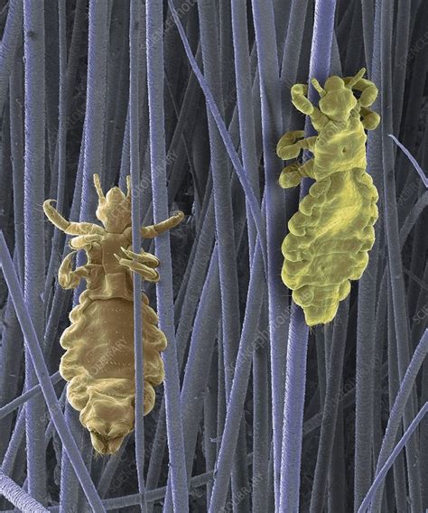 Head Lice Sem Stock Image F0273559 Science Photo Library
